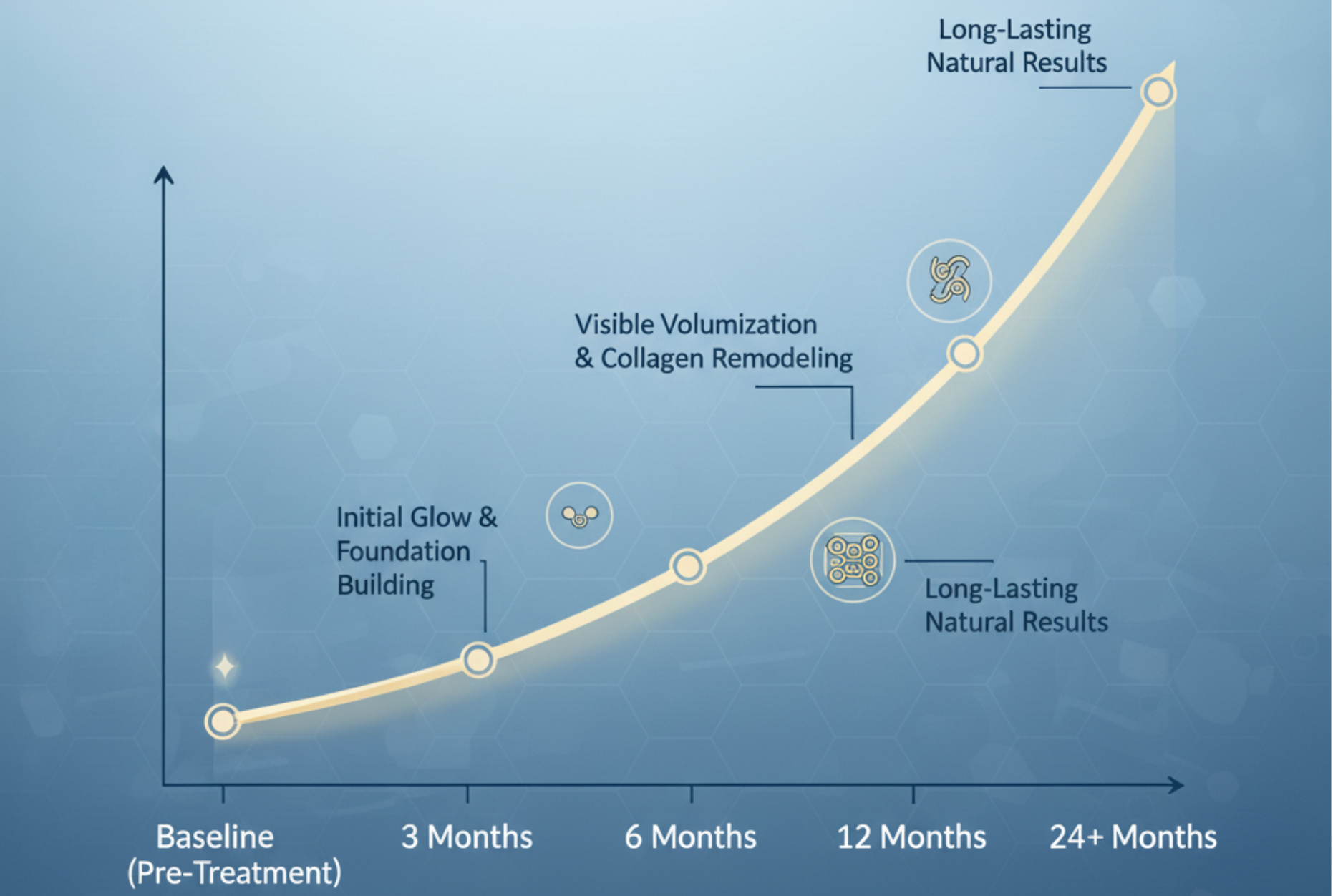 Progressive Sculptra results timeline showing gradual collagen building over 1-2+ years